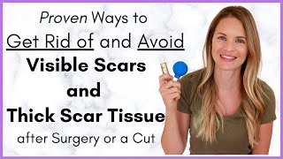 Proven Ways to Heal a Scar Quickly  Avoiding Scar Tissue after Surgery  By a Physical Therapist [upl. by Marcia356]