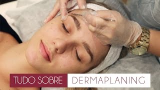 Tudo sobre DERMAPLANING [upl. by Nessaj]