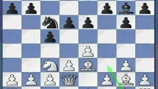 Chess Lesson 7 Part D Sicilian Defense Part 2 [upl. by Nealon]