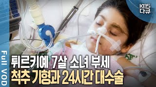 선천적 척추 기형 12시간 장거리 비행 24시간 대수술 마지막 희망을 안고 한국에 온 7살 튀르키예 소녀 부세  현장기록 병원  KBS 20070121 방송 [upl. by Ocirderf]