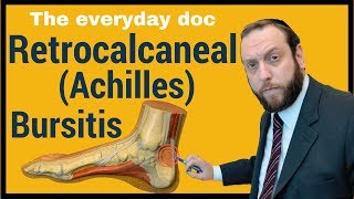 Retrocalcaneal bursitis or Achilles Bursitis [upl. by Ayekahs348]