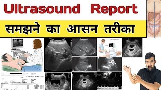 Ultrasound Report  Sonography  USG  Gynacology  Doctor  Nursing  Hospital  Treatment  Bhms [upl. by Klinges]