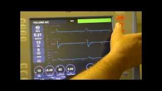 RESPIRATORY CARE AVEA set up [upl. by Hochman75]