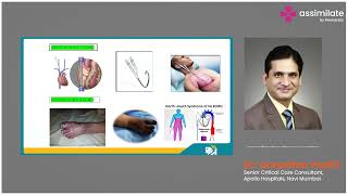 ECMO Critical Care Lifeline [upl. by Stefan700]