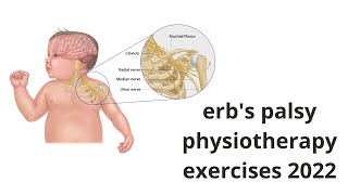 Erbs palsy physiotherapy exercises  Etiology Clinical features Diagnosis Treatment [upl. by Uriiah]