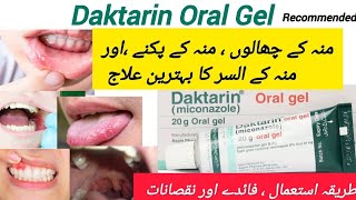 How to use Daktarin oral gel  uses in Urdu [upl. by Aretahs402]