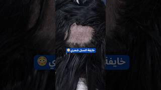 الشامبو الجاف بعد زراعة الحواجب [upl. by Clayson]