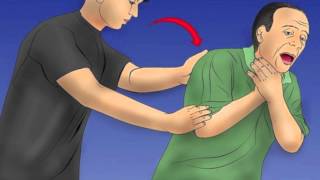 How to do the Heimlich Maneuver [upl. by Werdna]