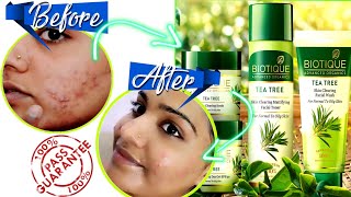 NEWSKIN CARE ROUTINE FOR BLEMISHED ACNE PRONE SKINBOUTIQUE TEA TREE NIGHT SKIN CARENEHASMARTY [upl. by Cleopatra239]