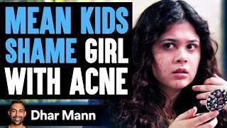 MEAN KIDS Shame Girl With ACNE What Happens Next Is Shocking  Dhar Mann [upl. by Atinna323]