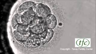 Human Embryo Growing from Fertilization to Day 6 Blastocyst [upl. by Gustafsson]