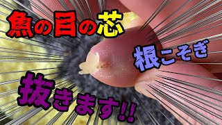 足裏の魚の目の芯しん抜き 魚の目の芯を根こそぎ自分で抜いてスッキりしたいfoot corn removal at home [upl. by Saxe274]