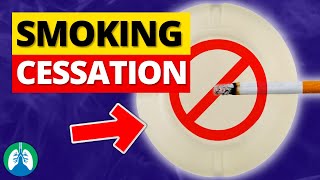 Smoking Cessation  Helping Patients Quit Smoking [upl. by Klayman]