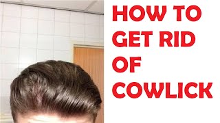 how to get rid of a cowlick on your hairline [upl. by Idieh]