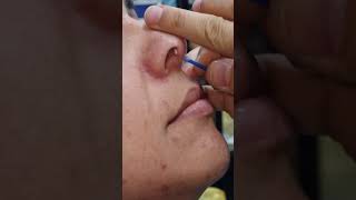 Piercing inflamado e saindo puz no septo o que fazer [upl. by Buzzell]