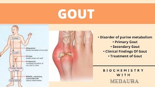 Gout  Biochemistry  First MBBS  MedAura [upl. by Crystie]