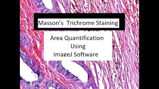 How to Measure different Colored Area in Images Using Image J Software [upl. by Maxey]