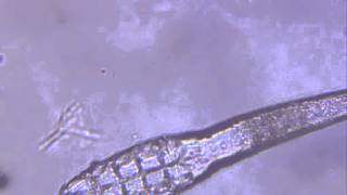 Demodex canis [upl. by Sitruc]