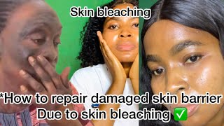 How to repair damaged skin barrier due to skin bleaching [upl. by Hallam]