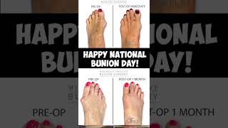 Minimally Invasive Bunion Surgery  Dr Nick [upl. by Sherourd]