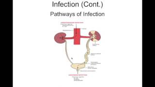 Chapter 27 Intrarenal Disorders BIOL300 [upl. by Enirroc301]