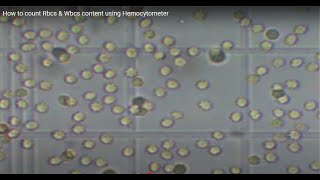 easy way to learn how to count RBCs using Haemocytometer [upl. by Aciraj]