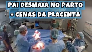 PAI DESMAIA DURANTE O NASCIMENTO  Vídeo de Parto Cesárea com cenas da placenta [upl. by Leela604]