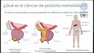 Enfermedad Metastásica por Cáncer de Próstata  INCMNSZ  Educación para la Salud [upl. by Leahcimnhoj]