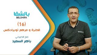 قطرة و مرهم توبرادكس [upl. by Camellia]