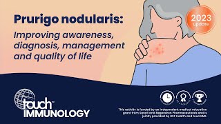 Prurigo nodularis Improving awareness diagnosis management and quality of life [upl. by Adur]