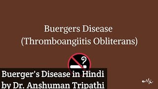 Buergers Disease in Hindi Language ☺️😊👍 [upl. by Oiled]