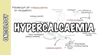 Hypercalcemia in malignancy  causes pathophysiology symptoms treatment [upl. by Onfre]