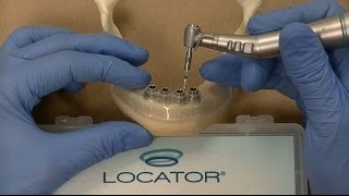 Zest LODI Mandibular Guided Surgery Demonstration  Technique [upl. by Aynad]