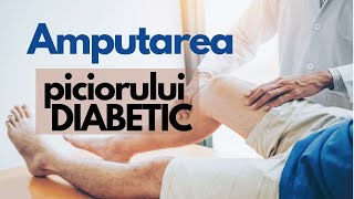 Complicațiile Piciorului Diabetic [upl. by Sulohcin]