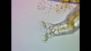 Rotifers Head and Cilia  Close View Under a Microscope [upl. by Charo498]