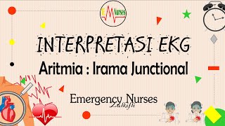 Junctional Rhythm ECG Rhythms [upl. by Durware]