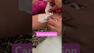 Cannulation technique nurses cannula shorts doctor neet mbbs bscnursing paramedicalytshorts [upl. by Berkshire558]