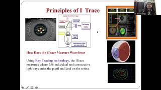 Lecture Wavefront Aberrometry and iTrace Screening and Planning Surgeries [upl. by Ringe]