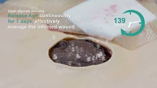 Dimora Ag Silver Calcium Alginate Wound Dressing [upl. by Anelrad430]