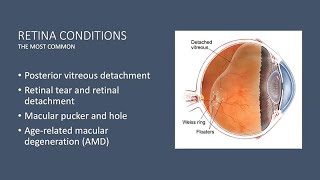 Demystifying Retinal Diseases [upl. by Otrebtuc]