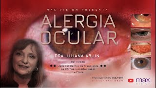 Alergia Ocular  Dra Liliana Abuin [upl. by Auoz416]