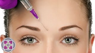 What is Botox  Botox Before and After Treatment [upl. by Romano287]