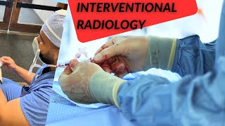 How to IR  Interventional Radiology [upl. by Hannavas]