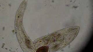 Gyratrix hermaphroditus Fam Polycystididae F Platyhelminthes 1 [upl. by Abbey916]