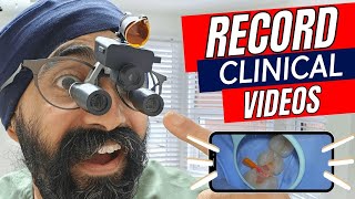 How to Record AWESOME Clinical Dental Videos with a Loupe Mounted Camera OXO 4K Dental Camera [upl. by Thorley]