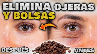 ELIMINA OJERAS BOLSAS y ARRUGAS en MINUTOS ANTIOJERAS EFECTIVO y NATURAL  Cómo quitar las Ojeras [upl. by Flem]