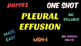 Pleural effusion  MSN1 [upl. by Petras]