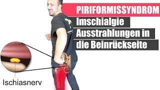 Piriformis Syndrom amp Ischiasschmerzen durch schwache Pomuskulatur  Dehnen hilft NICHT [upl. by Heywood181]