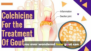 COLCHICINE Tablets For The GOUT Treatment [upl. by Hanala]