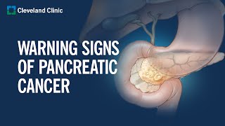 6 Warning Signs of Pancreatic Cancer [upl. by Jb]